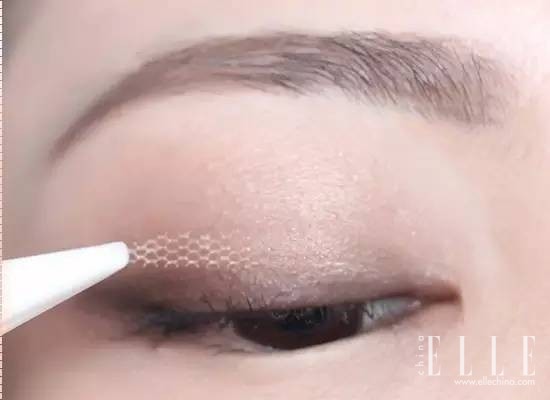 双眼皮100种整形图解,双眼皮整形全程讲解