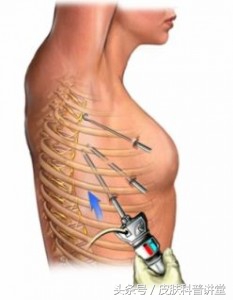 痛苦的时候应该怎么办,痛苦的症状和治疗方法