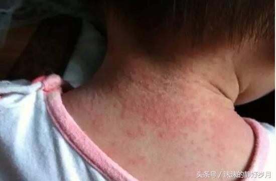 夏天到了应该给宝宝准备一些什么,夏天绝对不能对宝宝做的四件事