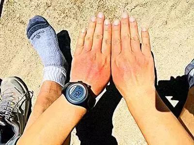 为了自己的皮肤，这位小伙却在“毁容线”上，寻找了3300公里