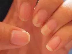 健康之路皮肤瘙痒的背后原因,养生之路皮肤瘙痒