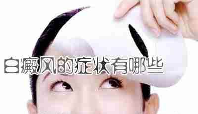 如何分辨白癜风的治愈率,白癜风泛发性和局部性怎么分辨