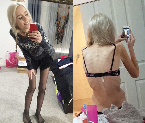 600多斤的胖妞减肥成功瘦到130斤,150斤胖妞