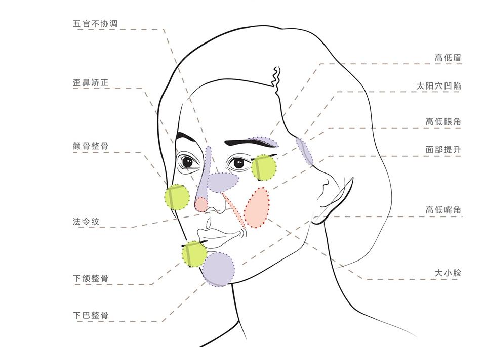 脊柱侧弯治疗最有效最快的办法,脊柱侧弯治疗有几种方法