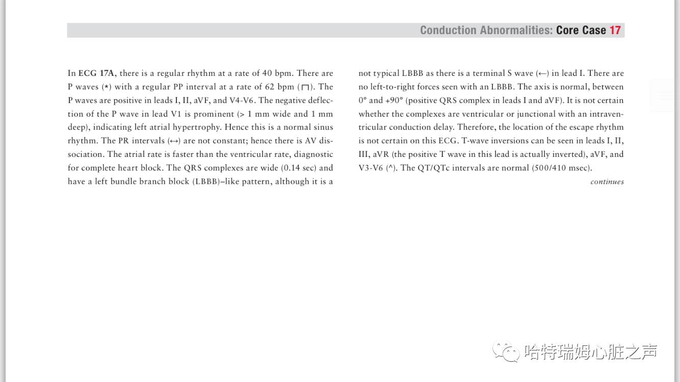 读心有术171,读心有术心电图
