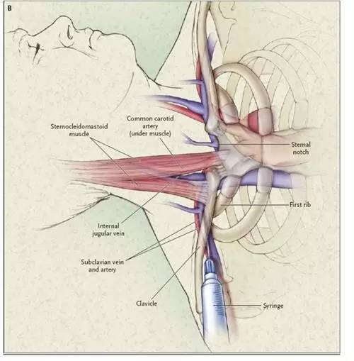 扎管的温度——北京医院肿瘤科护士手记|有故事的人