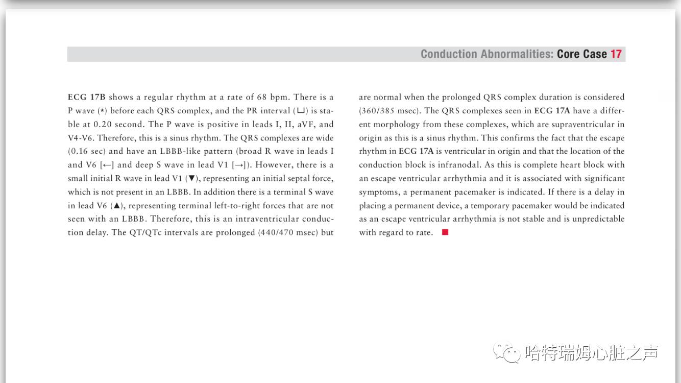 读心有术171,读心有术心电图