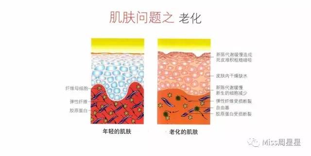 提拉紧致美容仪评测 (紧致提拉美容仪到底有没有用)