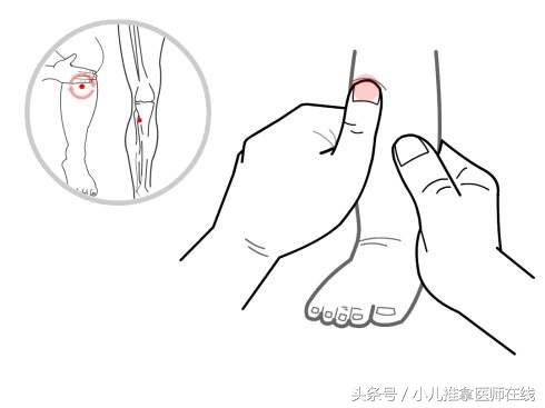 宝宝贫血小儿推拿,小儿推拿治贫血