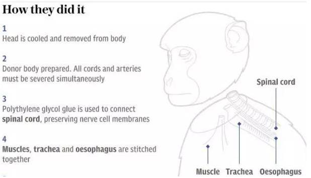 鎹釜瑙掑害鐪嬩腑鍥戒笌缇庡浗,涓鐪嬪尰鐢熺殑宸埆