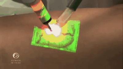 这个黑科技能照亮你的血管，让护士好好地给你扎针！