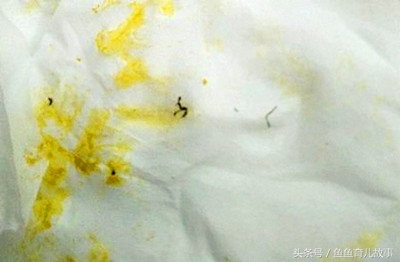 5个月宝宝拉虫子黑色条状,六个月宝宝拉出像虫子一样的东西