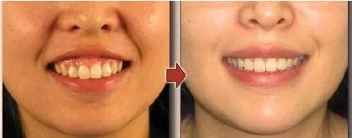 男生笑起来特别的丑怎么办,你长这么漂亮为什么却老说自己丑