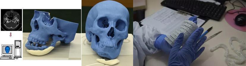 3d打印可以打造人体器官吗,哪里能进行人体3d打印