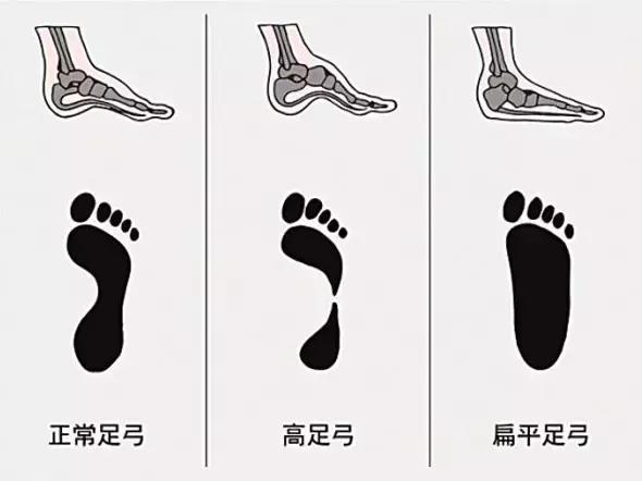 长时间走路脚跟痛怎么解决,足弓和脚后跟痛怎么回事