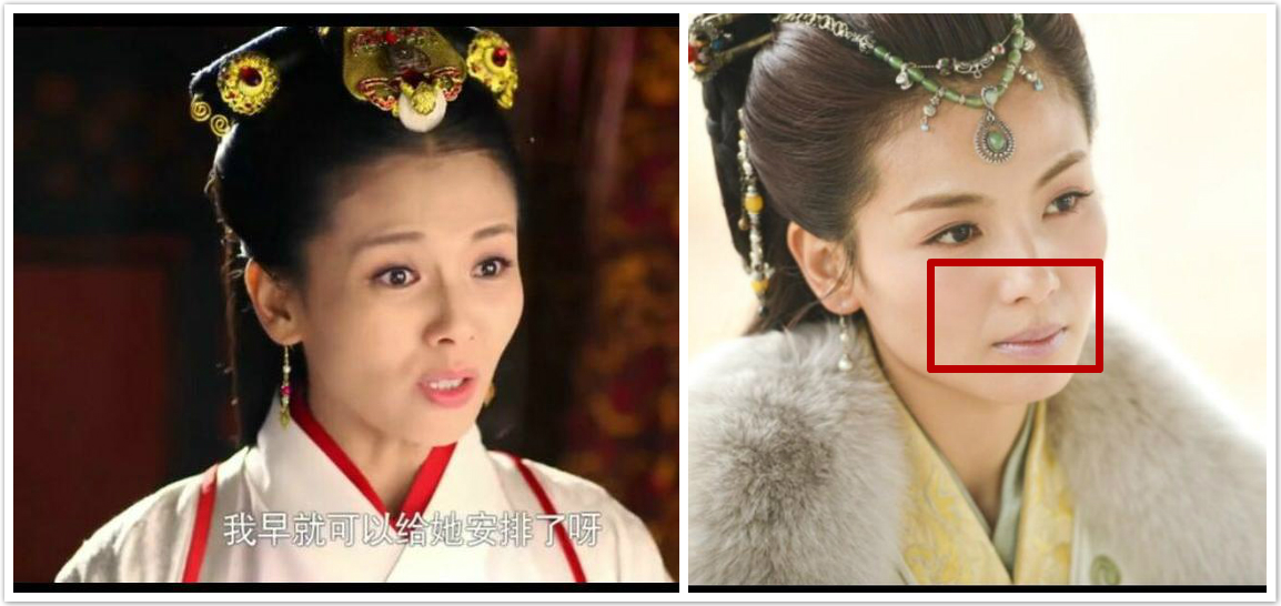 杨紫问怎么去除天生的法令纹!刘诗诗、娜扎也想知道答案啊!