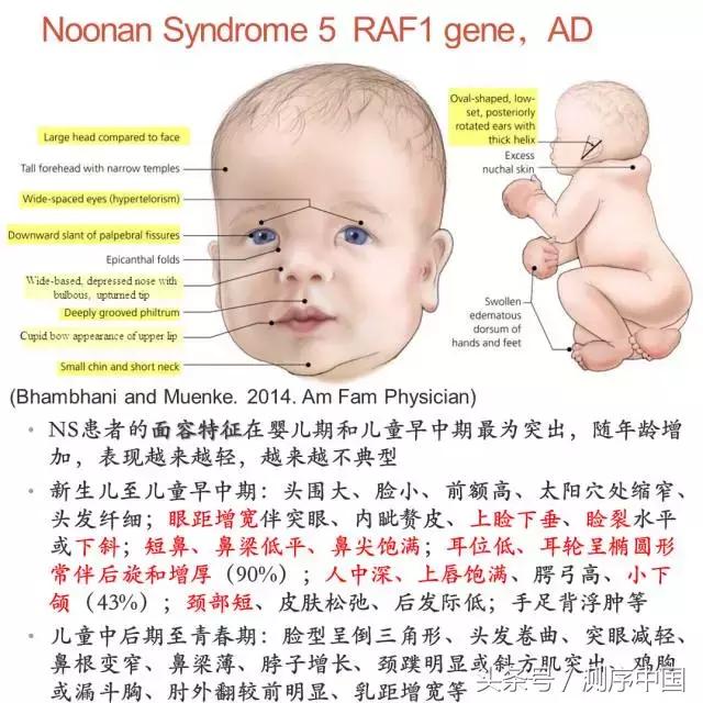 余永国儿科学博士,余永国教授