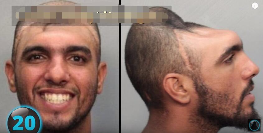 他们才是真正的超人，再大的挫折都挫不到他们，头不全又怎样