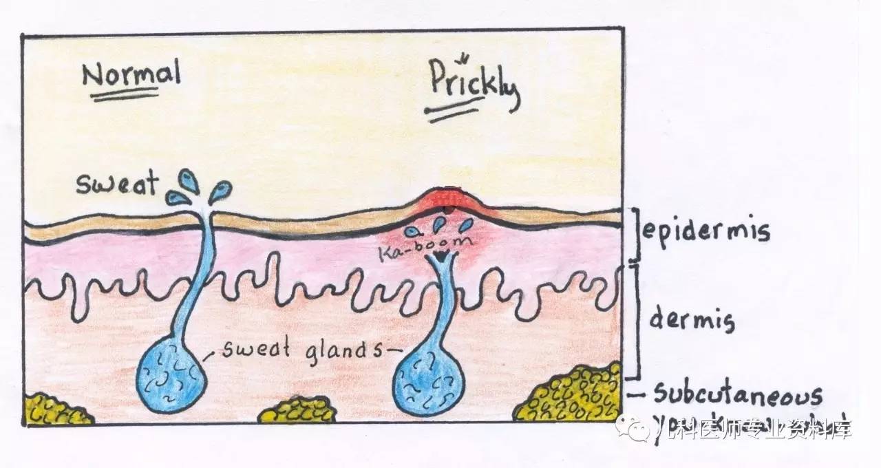 宝宝长痱子热疹,大人痱子和热疹