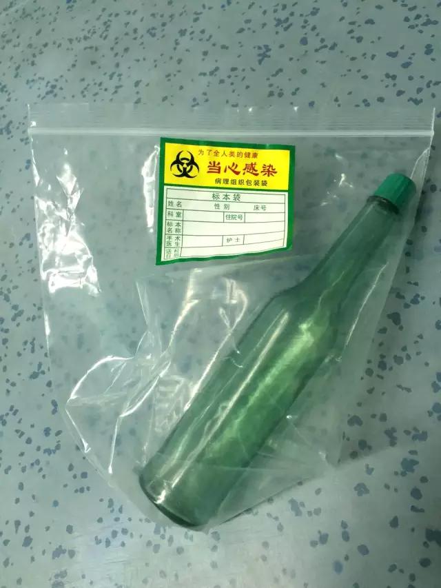 男子将花露水瓶插入肛门，险要其命