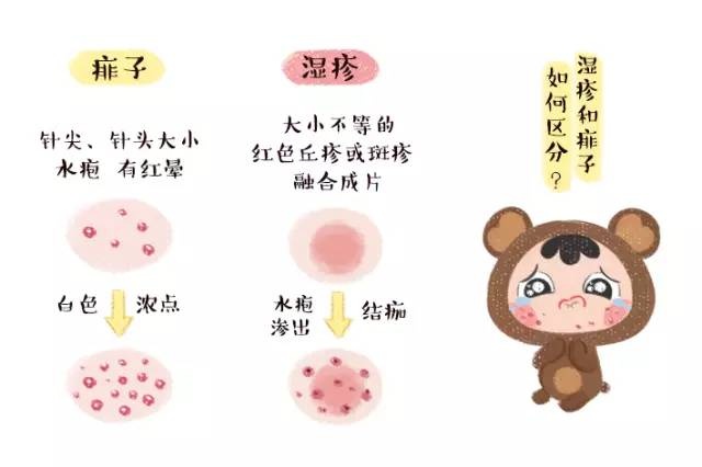 一直给宝宝用紫草油好吗,经常用爽身粉宝宝的皮肤会白吗