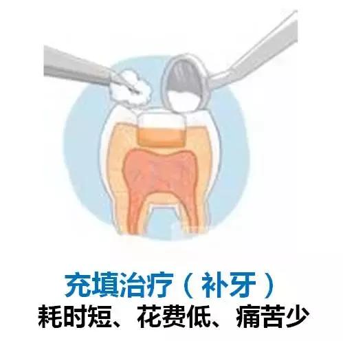 龋齿属于虫牙吗,蛀牙龋齿虫牙是怎么形成的