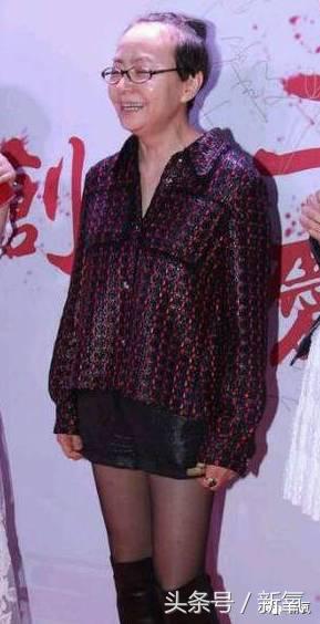 杨幂发际线还会回归吗,杨幂发际线秃到后脑勺