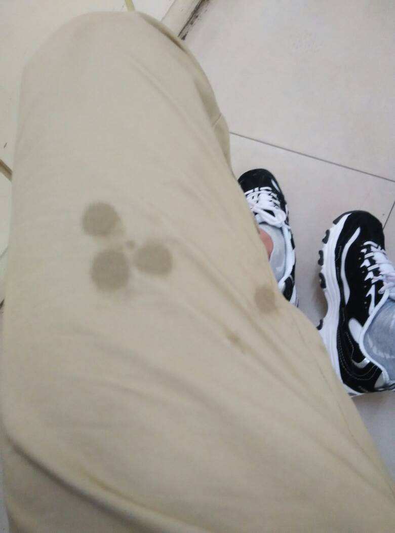 衣物染上食物油怎么去除,吃饭衣服上的油渍怎么去除