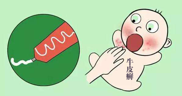 牛皮癣和银屑病一样吗有啥区别,治疗牛皮癣银屑病的外用止痒药