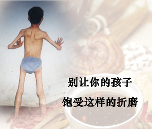 眼肌重症肌无力怎么治疗,重症肌无力治疗要多少钱