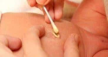 新生儿十二天脐带未脱落有出血,新生儿脐带出血要不要处理掉