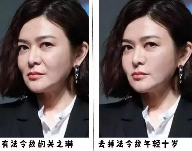 听说有法令纹的女孩子都很爱笑,爱笑的女生法令纹都不会太浅