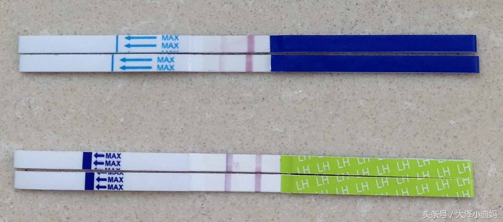 试管双胞胎hcg参考值,试管移植怀双胞胎的早期hcg参考值