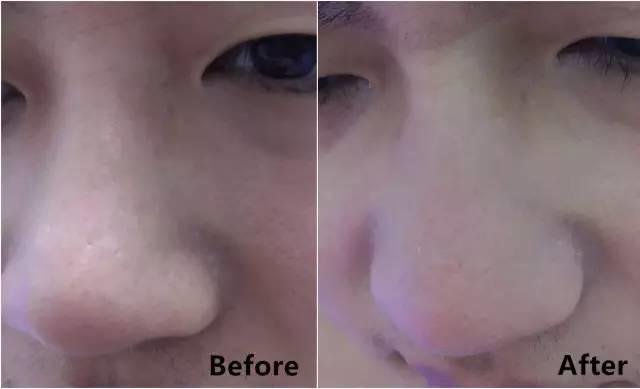 rydeen白泥清洁泥膜效果怎么样,平价好用的清洁泥膜测评