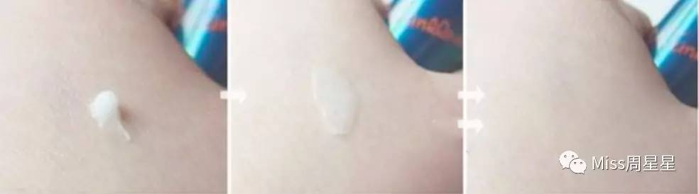 射频类美容仪能去除法令纹吗,改善抬头纹和法令纹的美容仪