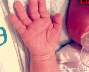 断掌的宝宝智商有问题吗,断掌的宝宝是不是要聪明些