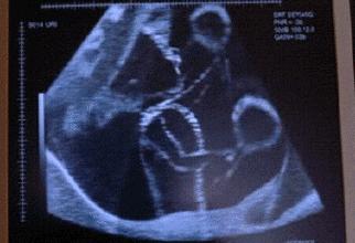 揭秘为何一天中这4个时候胎动最频繁？生过宝宝的妈妈表示认同