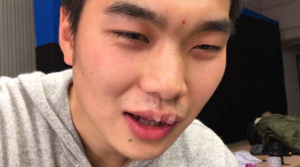 杭州一父母给孩子口服泡腾片,没想到后果竟这么严重,半条命快没了