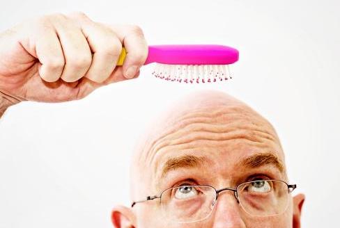 男性秃顶脱发去医院能治疗吗,男性秃顶脱发治疗最快的方法