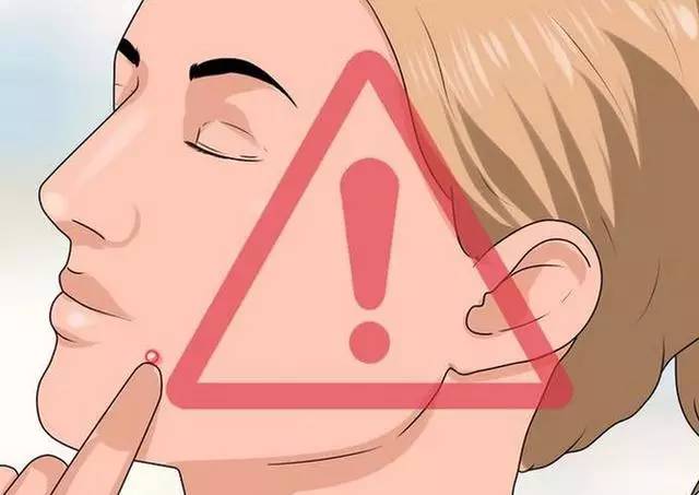 黑头痘痘粉刺脓包囊肿去除过程,脸上频繁长脓包痘痘是什么原因