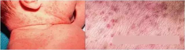 儿保体检有多坑,儿保体检准确么