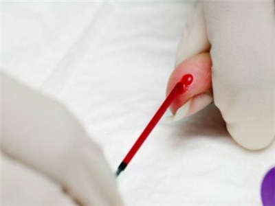 血管淤堵吃红豆能疏通血管吗,血管最怕堵一碗汤让血管干净如新