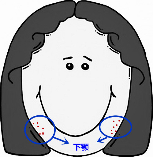 面部痘痘严重程度检测,痘痘面部分析