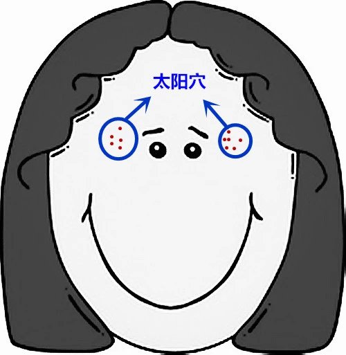 面部痘痘的症状图片和讲解,面部痘痘原因分析图片