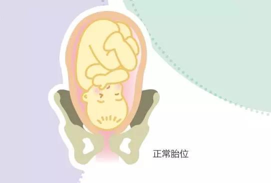 孕妈胎位不正的原因及纠正方法,孕妈临产胎位不正医生帮忙纠正