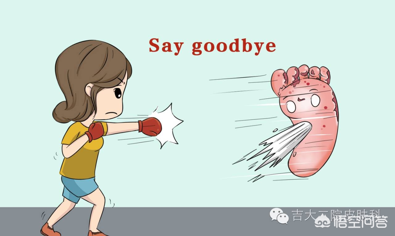 用于治疗脚气的11种外用药