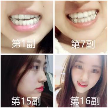 爱笑的人运气不会差牙齿黄,爱笑的人牙齿不好