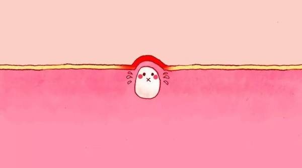 孩子长闭口粉刺怎么办,闭口粉刺总是长怎么办呢