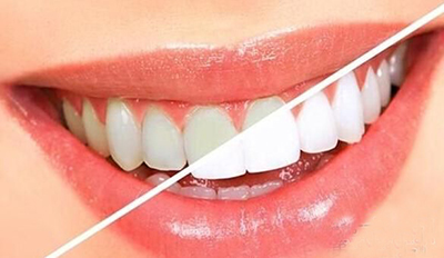 为什么女人的生活中离不开小苏打？看了你也离不了