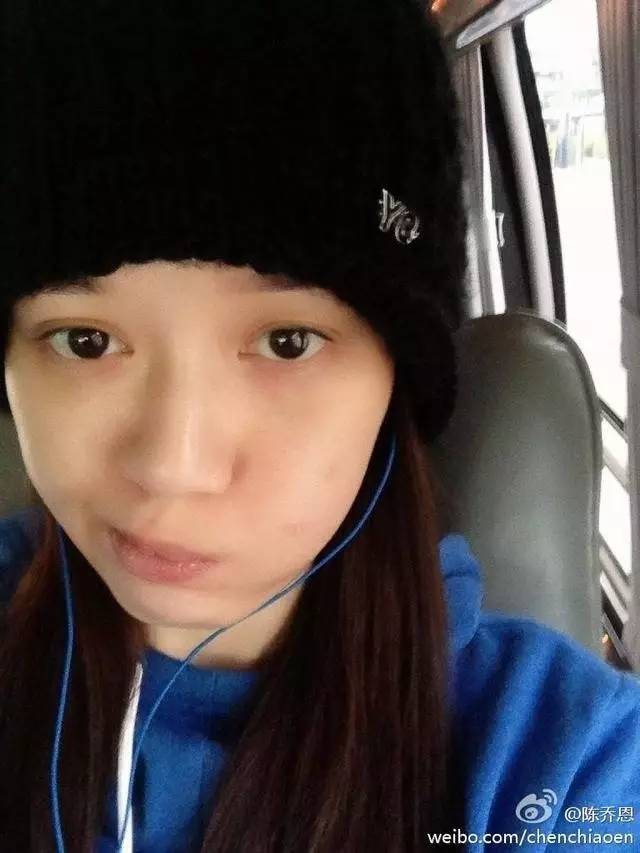 明星皮肤真的不长痘吗,脸上不长痘